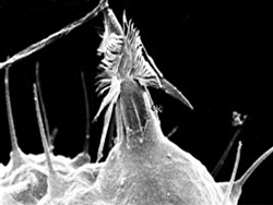 Nematocysty - snmek z elektronovho mikroskopu (Wikipedia)